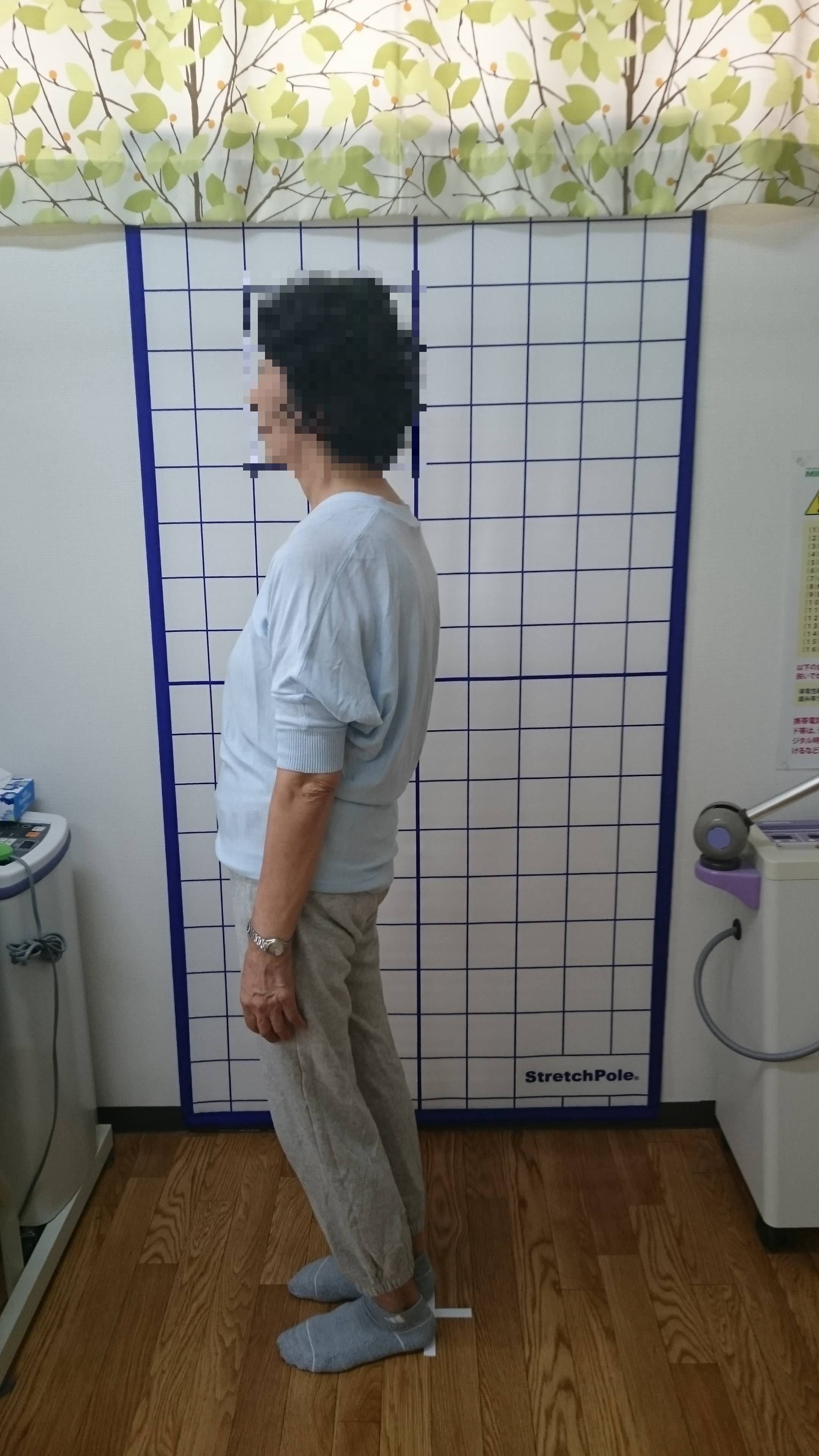 施術前 施術前