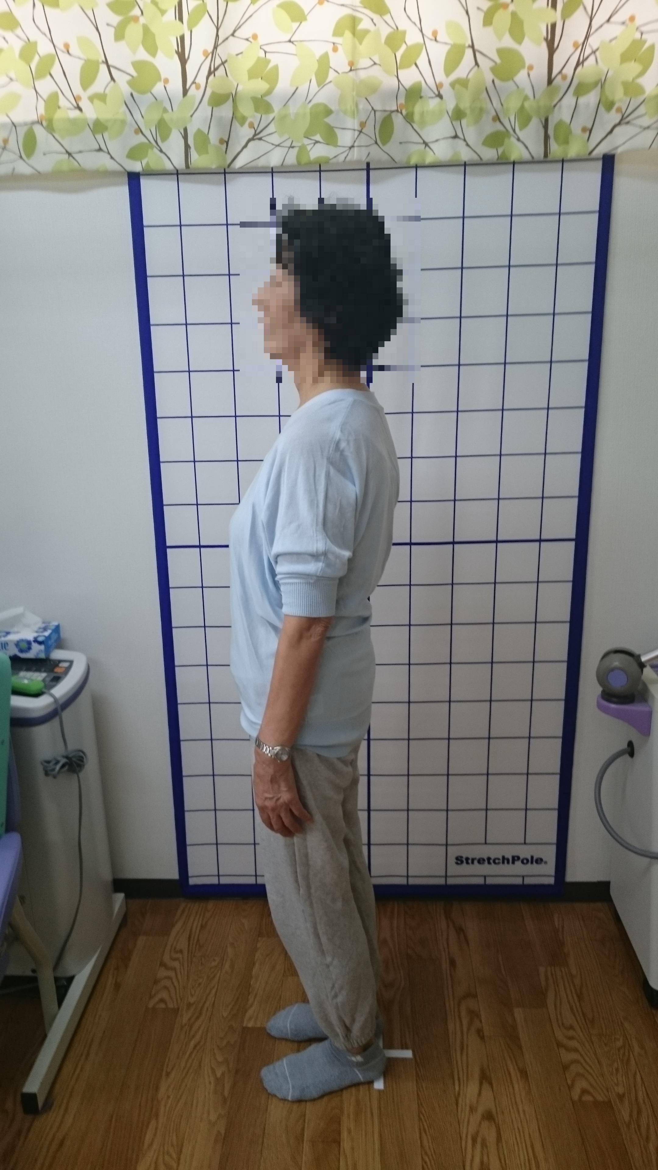 施術後 施術後