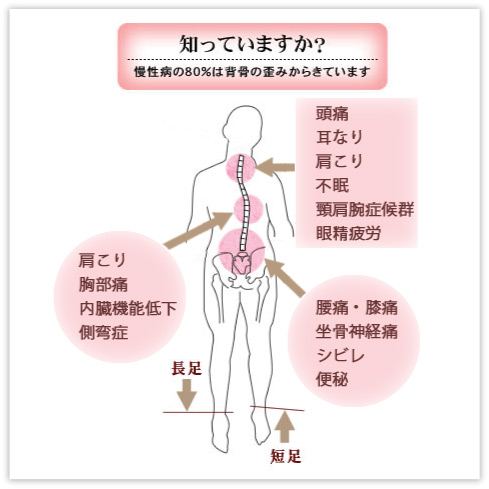 背骨のゆがみにより・・ 背骨のゆがみにより・・